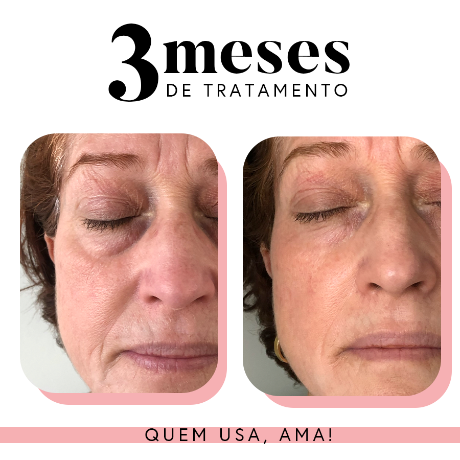 Fórmula Renovadora | 35 g